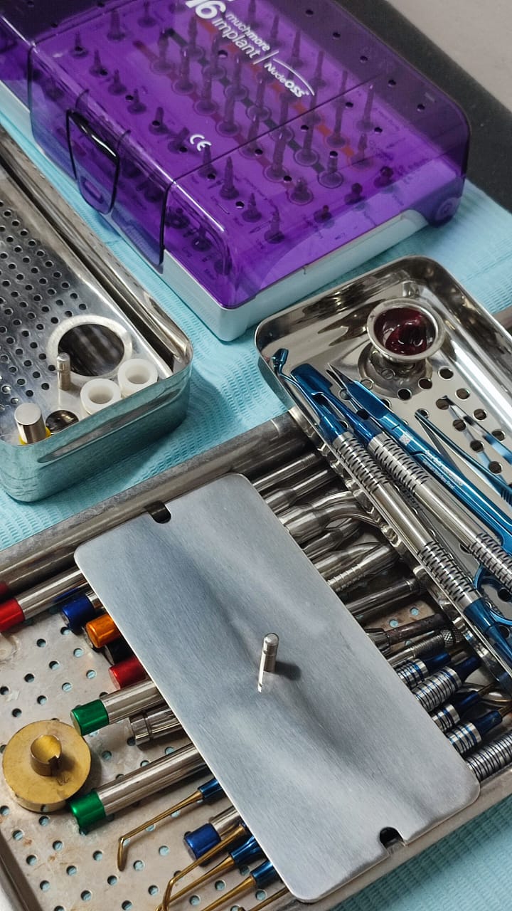 PR box and implant kit